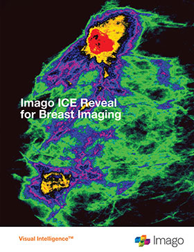 Breast imaging using the Imago Systems, Inc. Visual Intelligence® Platform to identify breast cancer sooner and with more accuracy.