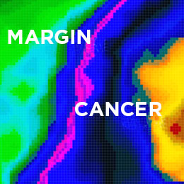 Image #2 with the Imago visual intelligence enhancements is colorful and cancer treatment is easy to assess.